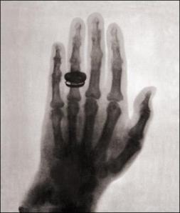 X-Ray image of hand, Wilhelm Konrad Roentgen